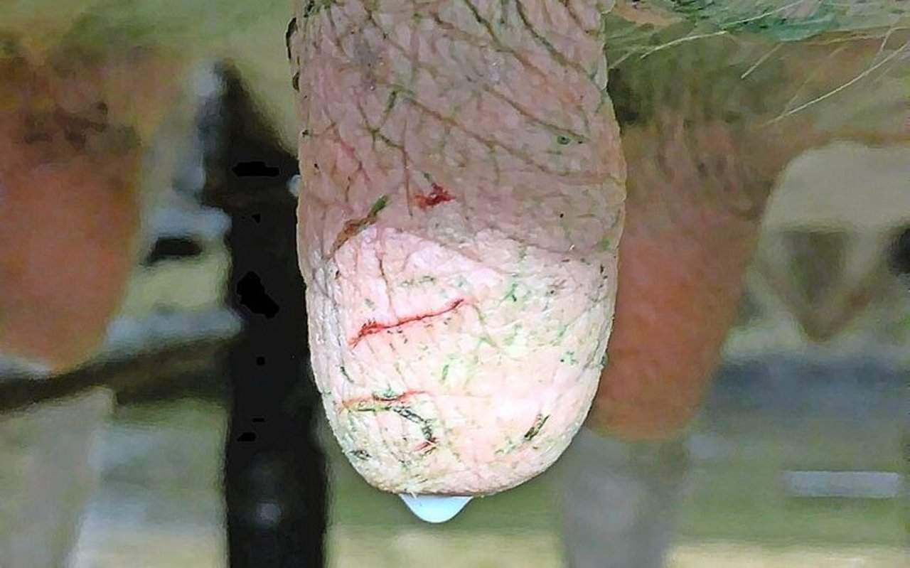 An rissiger Zitzenhaut können mehr Keime haften.