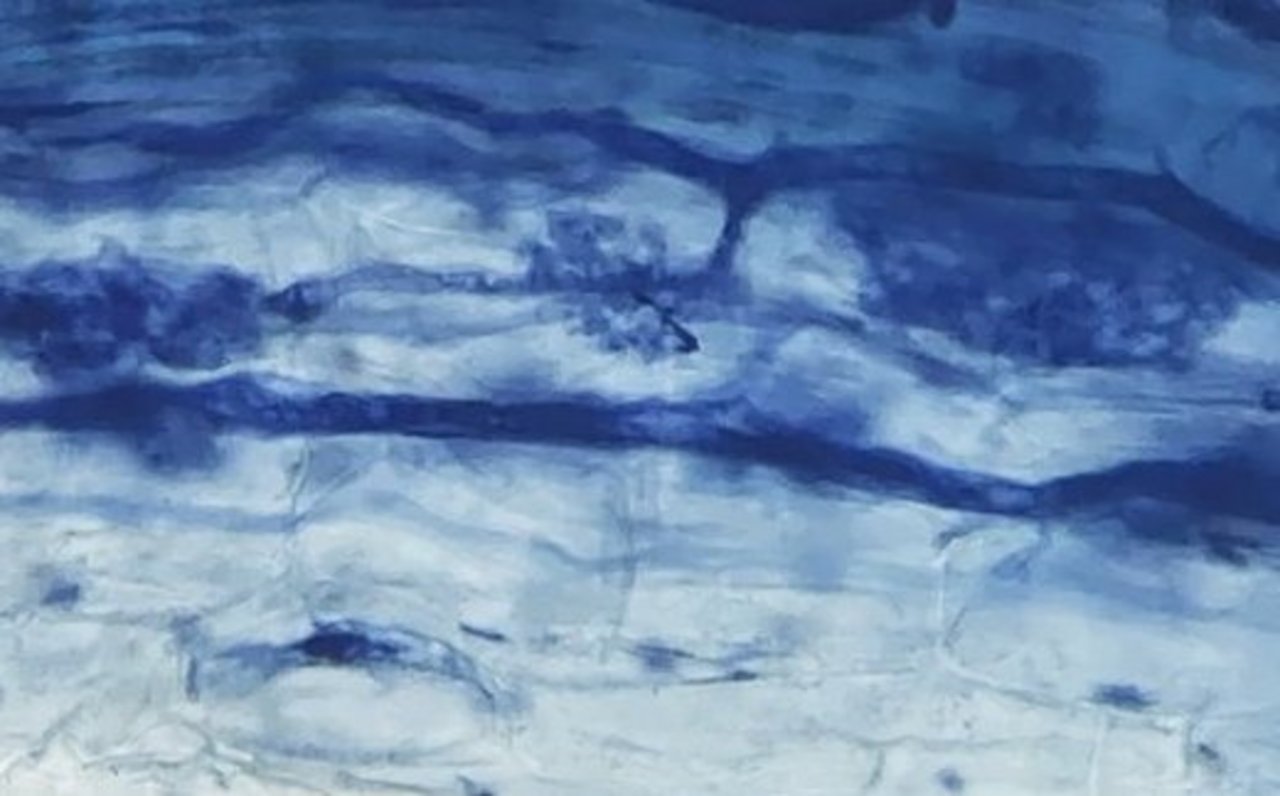 In den Zellen einer Maiswurzel sind Baum-artige blaue Strukturen zu erkennen. Das sind Mykorrhiza-Pilze.