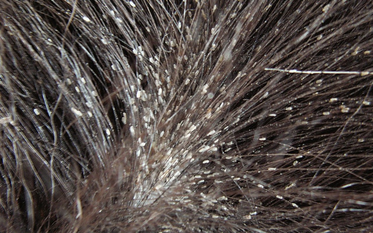 Nissen von Haarlingen oder Läusen kleben oft gut erkennbar an Haaren im Hals- oder Rückenbereich befallener Tiere. Bild: BGK/SSPR
