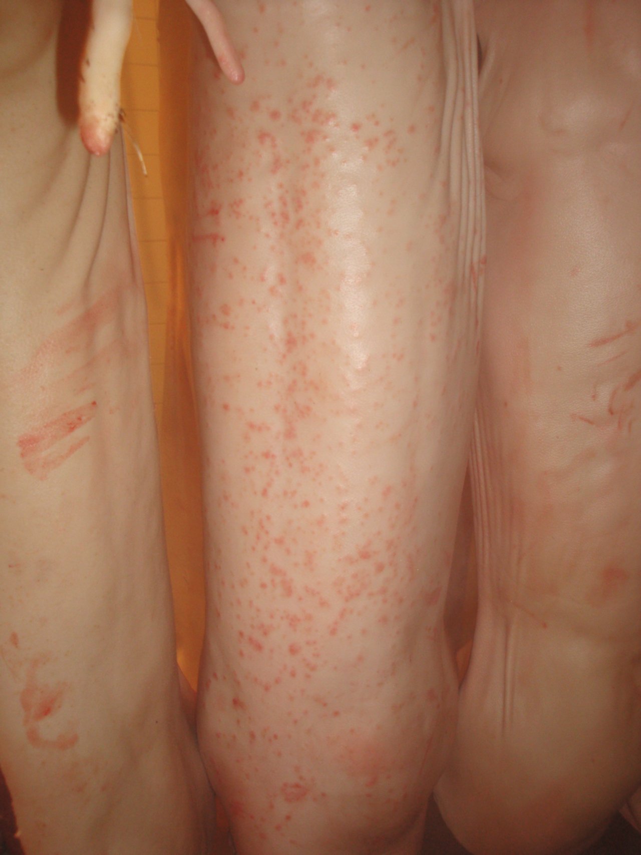 Spätestens im Kühlraum kommt die Schweineräude durch die Pusteln im Fleisch deutlich zum Vorschein. Bild: Suisag
